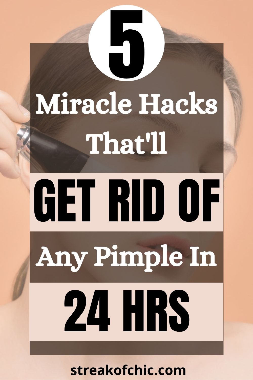 5 Easy Hacks To Get Rid of a Nasty Pimple in 24 Hours